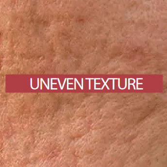 uneven